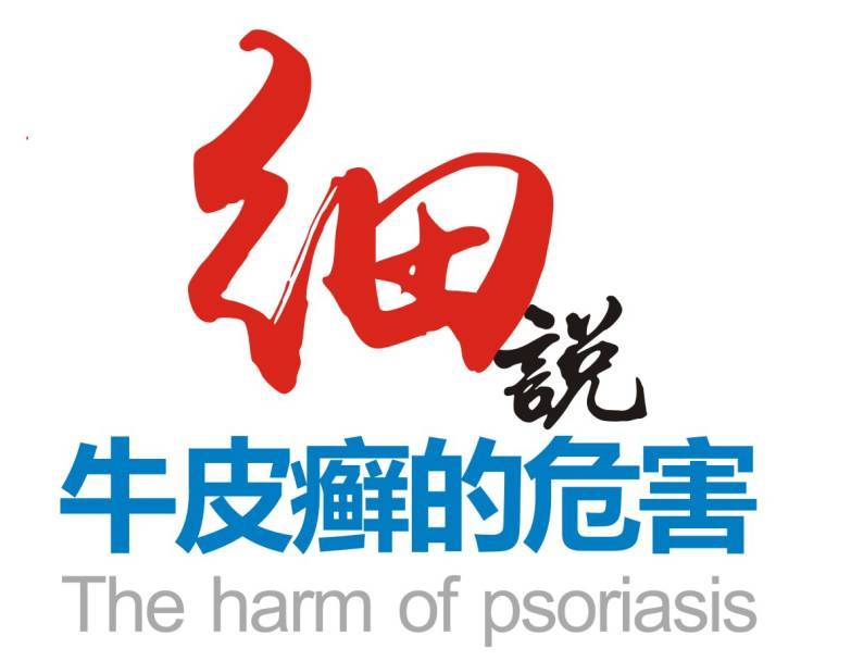 银屑病会不会危害生命健康